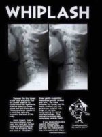 Richard G. Nassab, D.C.-Accident Doctor Pleasanton, CA